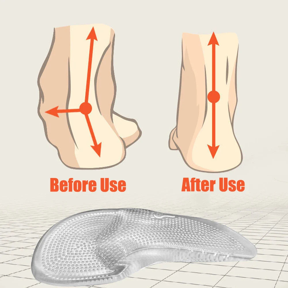 Adena® I Semelles Orthopédiques En Gel De Silicone